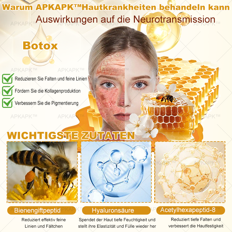 Hergestellt in Deutschland ✨✨AРKAРК™ Bienengift Umfassende Creme – Anti-Aging, Feuchtigkeitsspendend, Hautreparatur, Hautbildverbesserung, Akne- und Pigmentfleckenbehandlung, Warzen- und Muttermalentfernung, Linderung bei Psoriasis