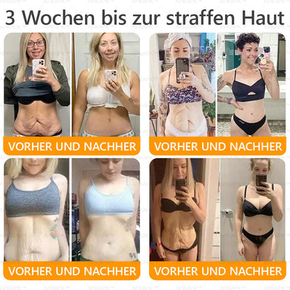 APKAPK®--Nur noch 10 Dosen! Greife jetzt den exklusiven 30% Rabatt ab! Halte deine Haut in nur 1 bis 3 Wochen jugendlich und strahlend. Verpasse nicht deine Chance! Handeln Sie schnell! 180 Tage Rückerstattungs-Garantie!