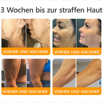 APKAPK®--Nur noch 10 Dosen! Greife jetzt den exklusiven 30% Rabatt ab! Halte deine Haut in nur 1 bis 3 Wochen jugendlich und strahlend. Verpasse nicht deine Chance! Handeln Sie schnell! 180 Tage Rückerstattungs-Garantie!