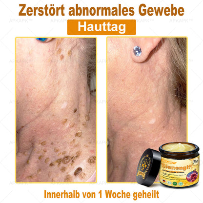 Hergestellt in Deutschland ✨AРKAРК™ Bienengift Umfassende Creme – Anti-Aging, Feuchtigkeitsspendend, Hautreparatur, Hautbildverbesserung, Akne- und Pigmentfleckenbehandlung, Warzen- und Muttermalentfernung, Linderung bei Psoriasis
