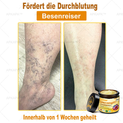 Hergestellt in Deutschland ✨AРKAРК™ Bienengift Umfassende Creme – Anti-Aging, Feuchtigkeitsspendend, Hautreparatur, Hautbildverbesserung, Akne- und Pigmentfleckenbehandlung, Warzen- und Muttermalentfernung, Linderung bei Psoriasis
