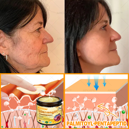 Hergestellt in Deutschland ✨AРKAРК™ Bienengift Umfassende Creme – Anti-Aging, Feuchtigkeitsspendend, Hautreparatur, Hautbildverbesserung, Akne- und Pigmentfleckenbehandlung, Warzen- und Muttermalentfernung, Linderung bei Psoriasis