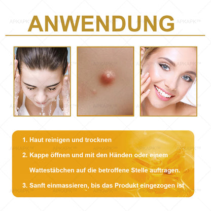APKAPK®--Nur noch 10 Dosen! Greife jetzt den exklusiven 30% Rabatt ab! Halte deine Haut in nur 1 bis 3 Wochen jugendlich und strahlend. Verpasse nicht deine Chance! Handeln Sie schnell! 180 Tage Rückerstattungs-Garantie!